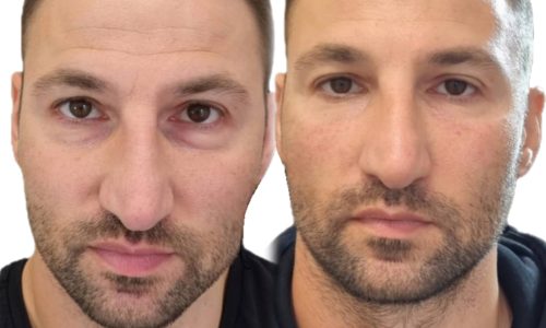 InCollage_20251126_145122231